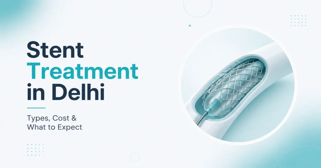 blog-stent-treatment-in-delhi