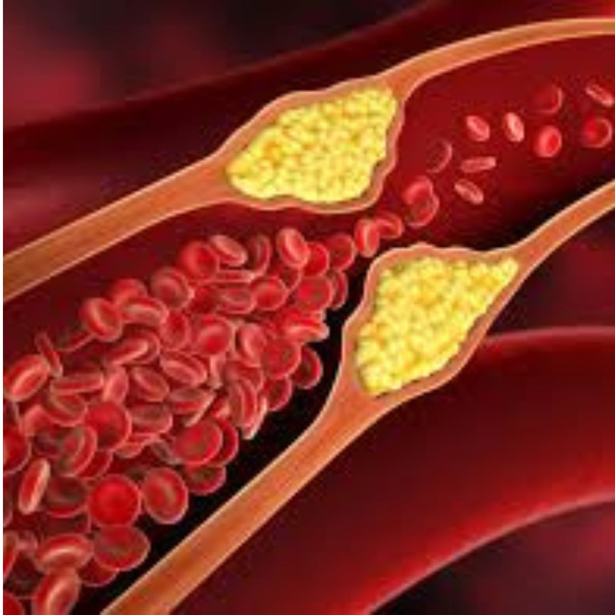 Lipid Specialist