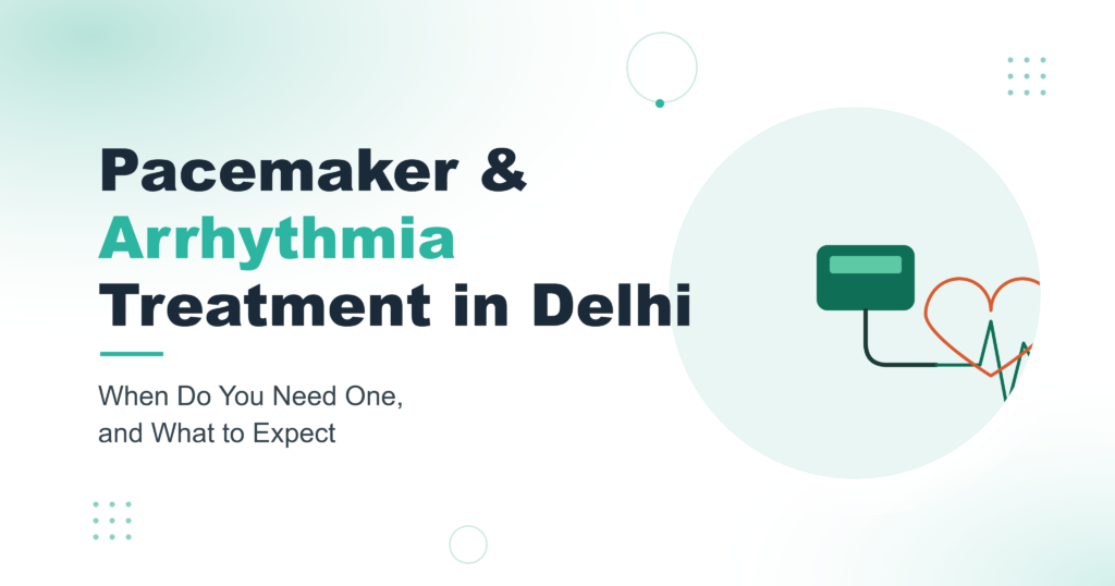 Pacemaker & Arrhythmia Treatment in Delhi