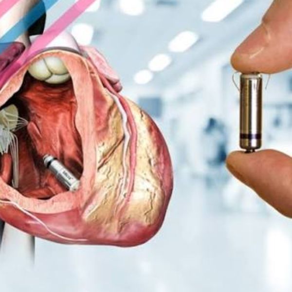 Leadless Pacemaker