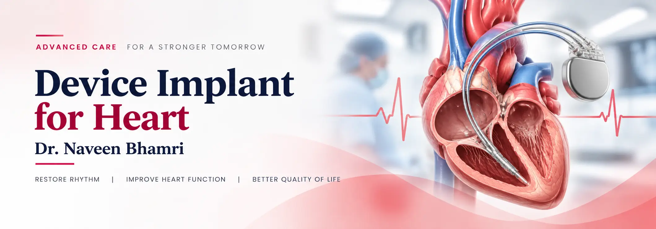 Cardiac device implantation